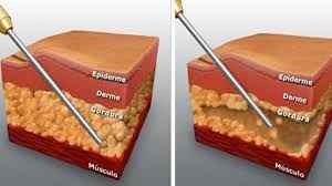 Image Title My Image